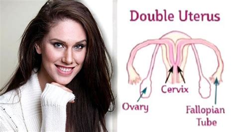 frauen mit 2 vaginas|Woman with uterus didelphys reveals what it’s like to have two .